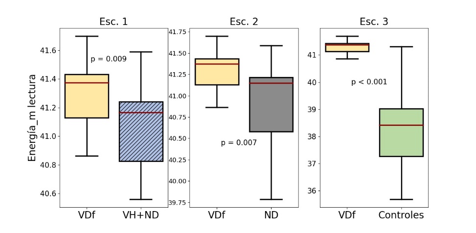 Distribución Energía_m de la lectura del grupo VDf en los escenarios evaluados