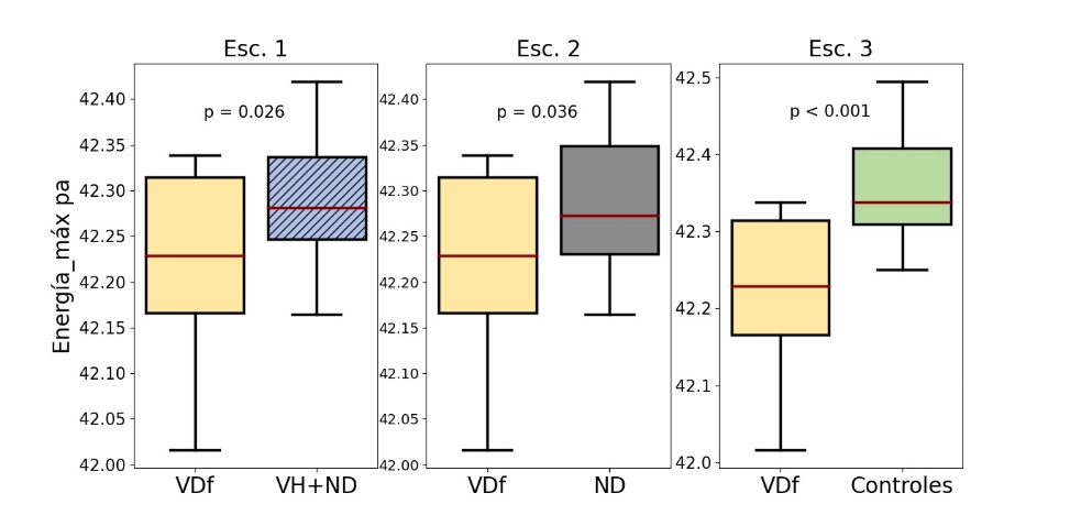 Distribución de Energía_máx de la tarea DDK \pa\ del grupo VDf en los escenarios propuestos