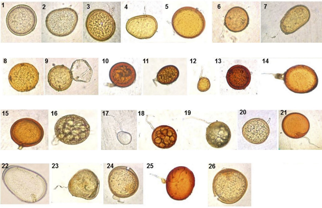 Ejemplo de esporas de HFMA. 1. Acaulospora denticulata; 2. Acaulospora scrobiculata; 3. Acaulospora mellea; 4. Acaulospora morrowiae; 5. Acaulospora sp. 1; 6. Acaulospora sp. 2; 7. Acaulospora sp. 3; 8. Acaulospora sp. 4; 9. Entrophospora infrequens; 10. Glomus citricola; 11. Glomus deserticola; 12. Glomus fasciculatum; 13. Glomus geosporum; 14. Glomus invermaium; 15. Glomus macrocarpum; 16. Glomus microaggregatum; 17. Glomus occultum o Paraglomus occultum; 18. Glomus sp. 1; 19. Glomus sp. 2; 20. Glomus sp. 3; 21. Scutellospora heterogama; 22. Scutellospora pellucida; 23. Scutellospora savannicola; 24. Scutellospora sp. 1; 25. Scutellospora sp. 2; 26. Scutellospora sp. 3.